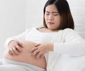 اگزما در بارداری