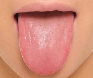 سفید شدن زبان